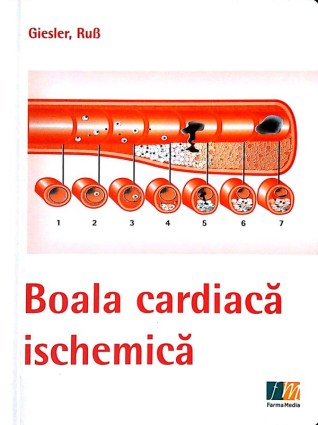 Boala cardiaca ischemica